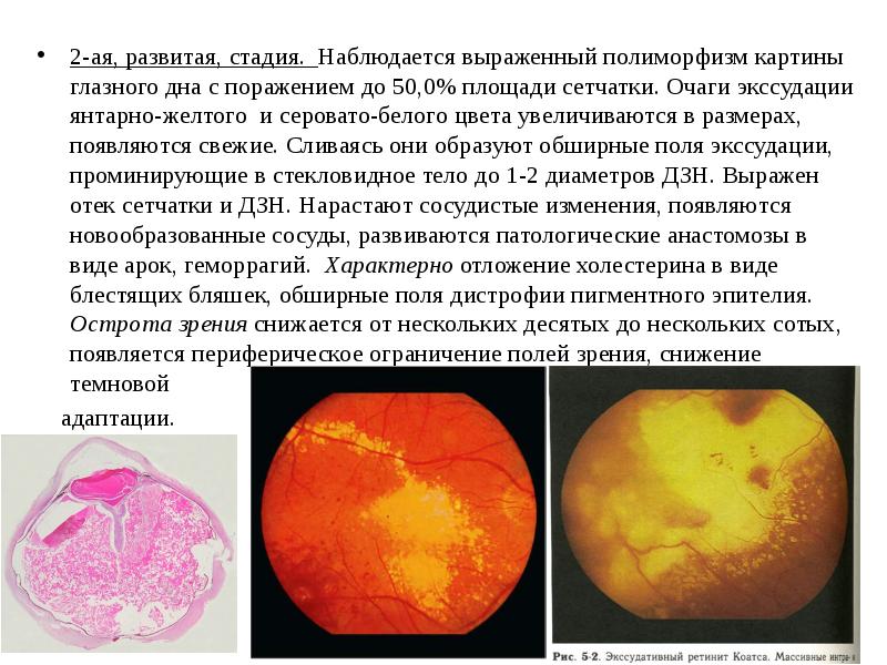 Наследственные заболевания проект