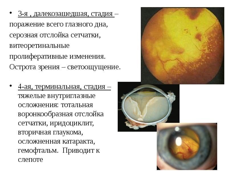 Наследственные заболевания проект