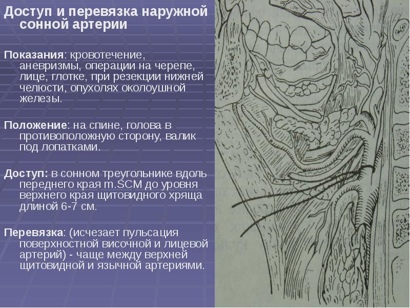 Оперативная хирургия лицевого отдела головы презентация