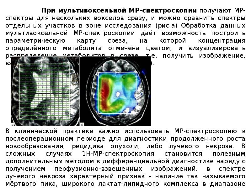 Принцип получения изображения мрт