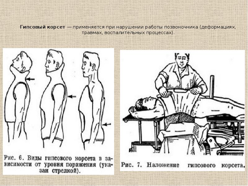 Вывихи и их лечение хирургия презентация