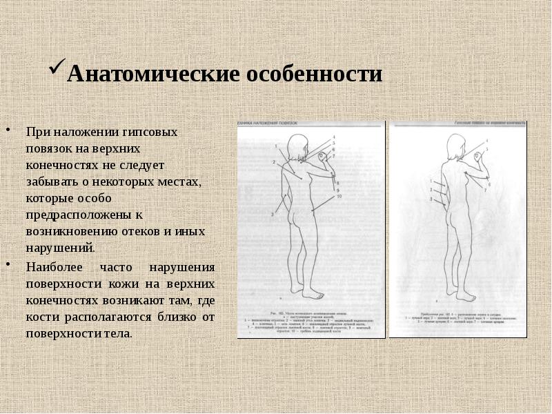 Лечение переломов и вывихов презентация