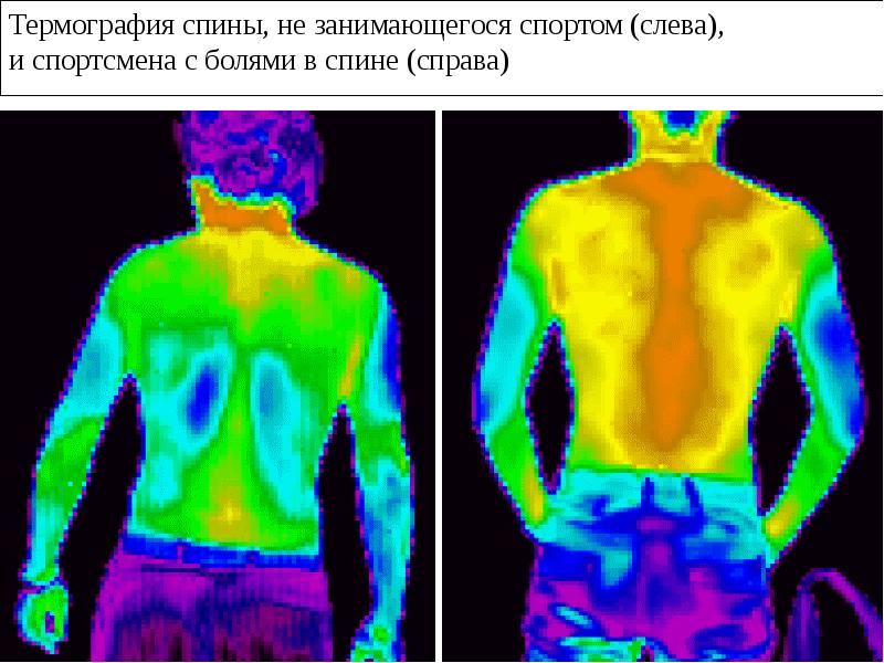 Тепловые параметры человека. Термография. Медицинская термография. Термография в медицине. Термография щитовидной железы.