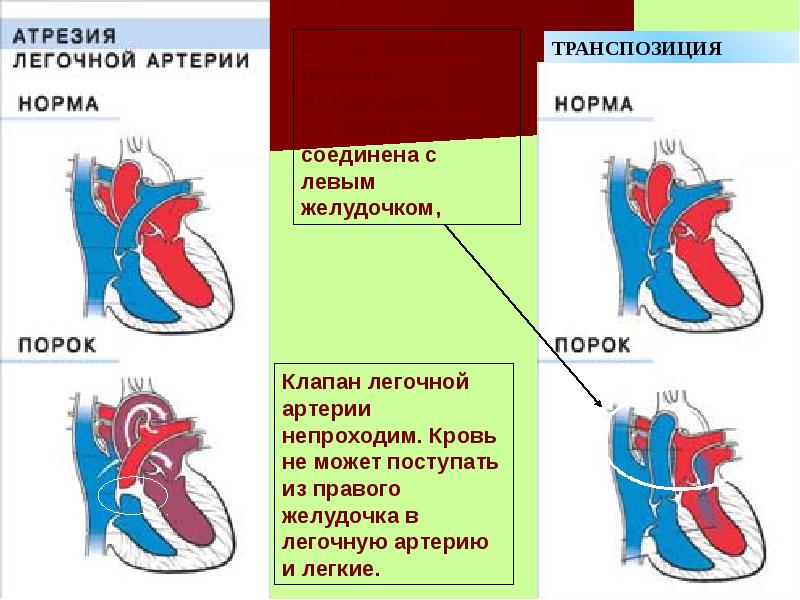 Магистральные сосуды