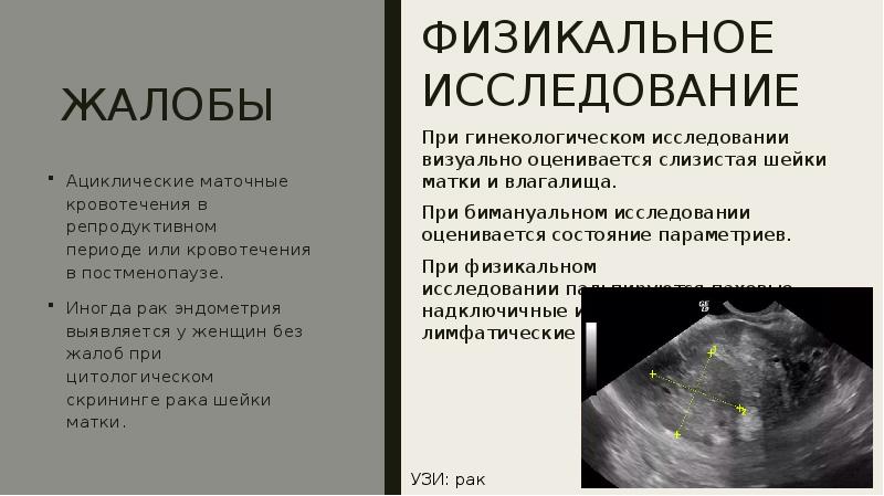 Презентация опухоли маточных труб