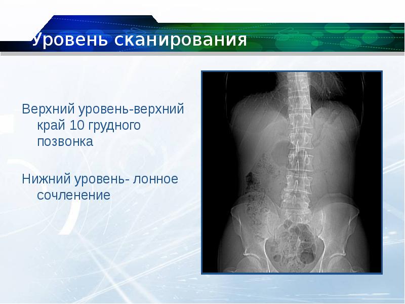 Аномалии почек презентация