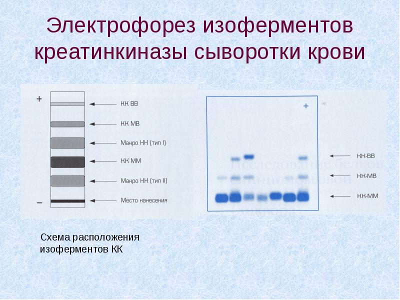 Электрофорез белков. Электрофореграмма белков сыворотки крови презентация.. Электрофорез изоферментов креатинкиназы. Электрофорез сыворотки крови. Электрофорез липопротеинов сыворотки крови.