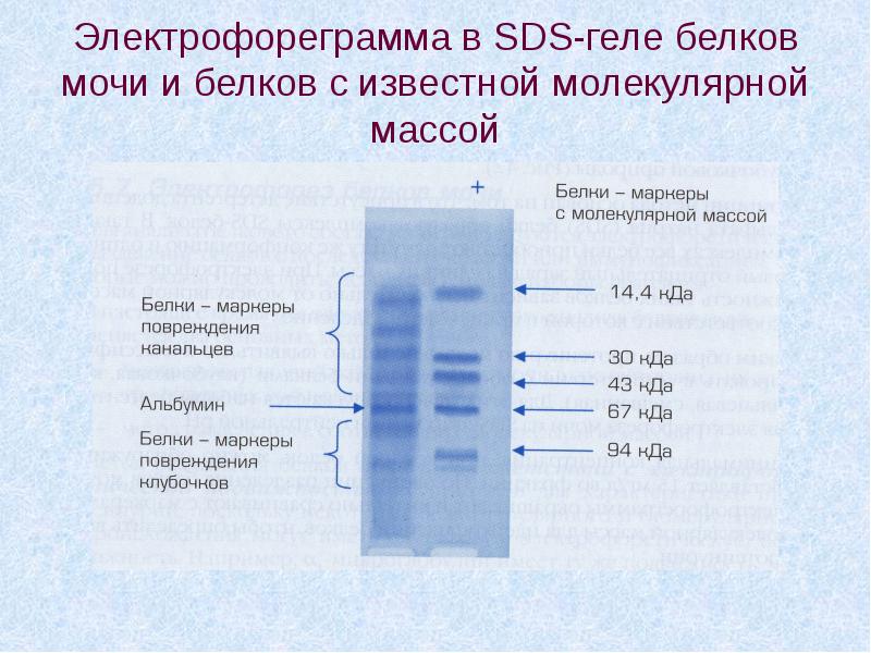 Направление на электрофорез образец