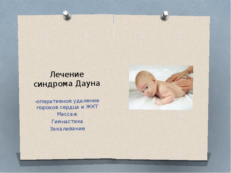 синдром дауна лечится. методы профилактики синдрома дауна. профилактика детей с синдромом дауна. методы профилактики синдрома дауна. синдром дауна лечится.