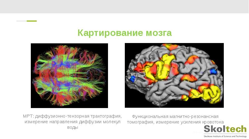 Метод мозга. Картирование коры головного мозга. Картирование электрической активности мозга. ЭЭГ картирование головного мозга.