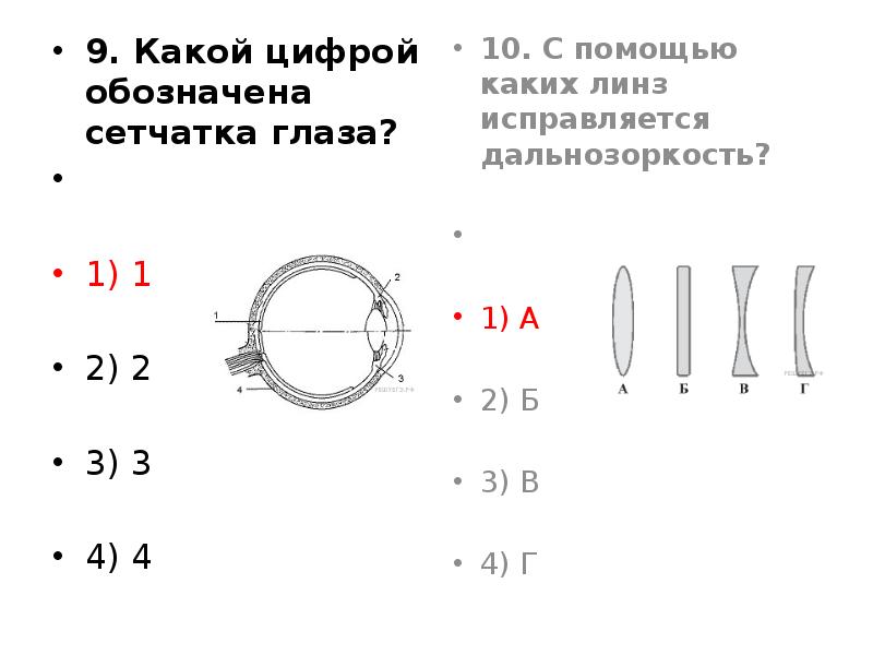 Какой цифрой обозначена сетчатка глаза