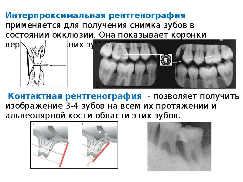 Можно делать рентген