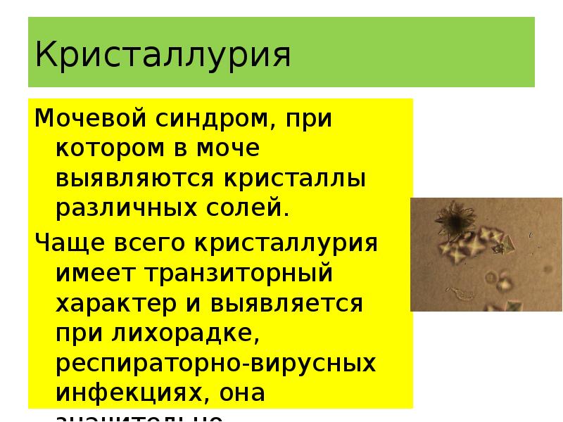 сбор мочи на кристаллурию. кристаллурия. кристаллурия что это такое у женщин. суточная моча на кристаллурию. кристаллурия симптомы.
