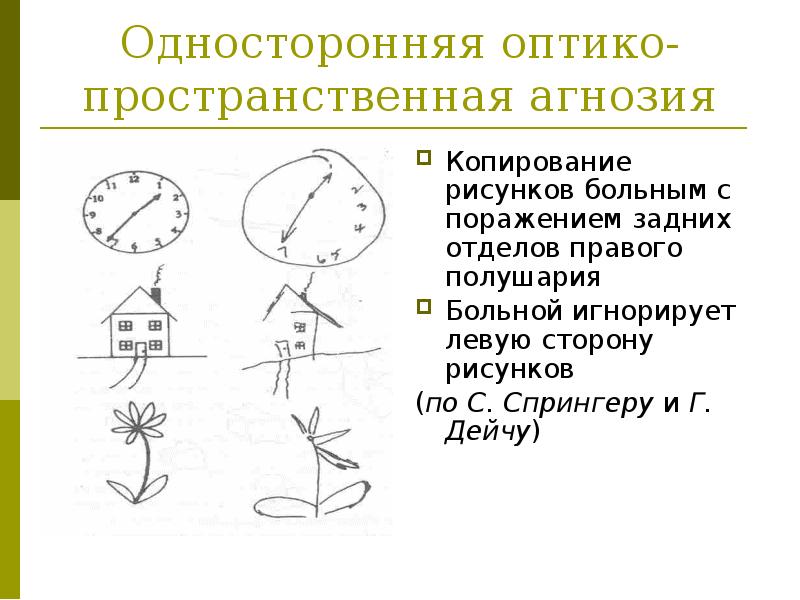 1 схему рисунок отражающие нарушения зрительного внимания игнорировании какой либо стороны