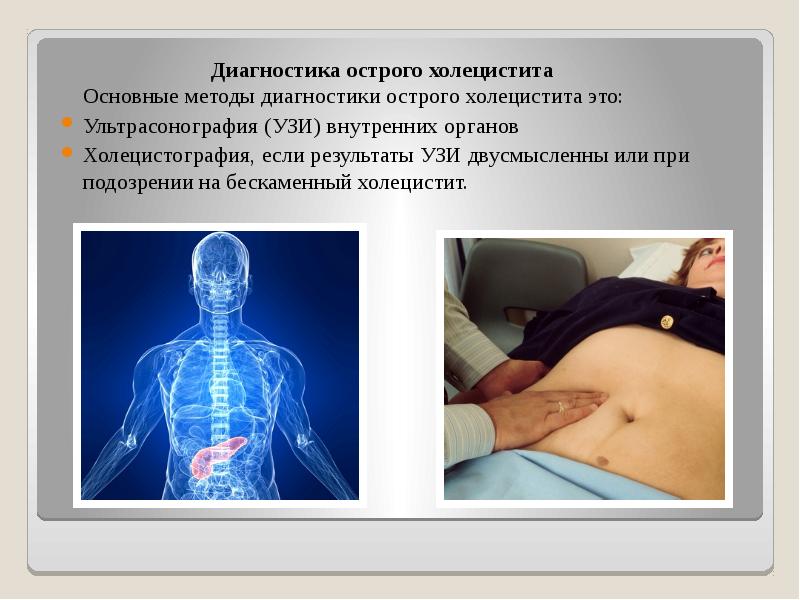 Живот при остром холецистите. Диагностика острого холецистита. Методы исследования острого холецистита. Алгоритм диагностики острого холецистита. Диагноз острый живот.