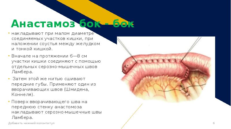 Кишечные анастомозы. Кавакавалный анастамоз. Тестикуло-сафненный анастамоз. Можно ли при анастомозе кишечника есть малину.