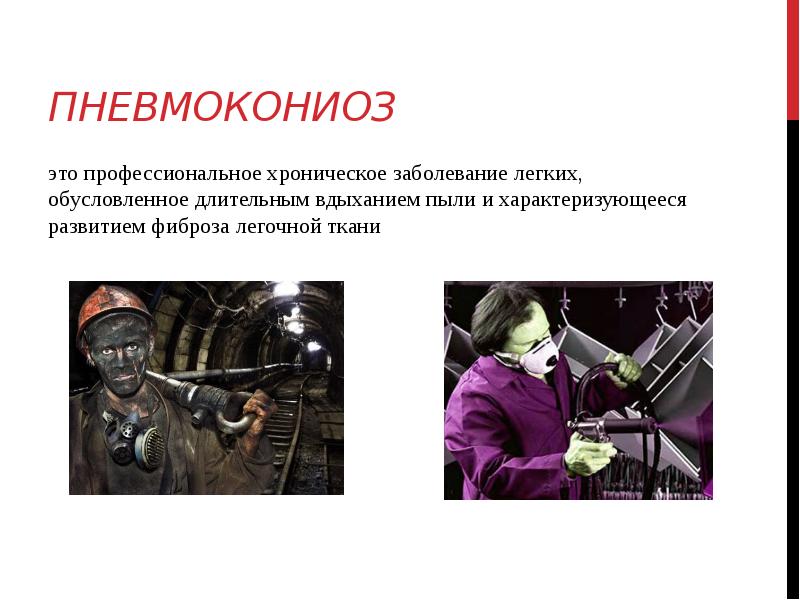 Пневмокониоз это профессиональное хроническое заболевание легких, обусловленное длительным вдыханием пыли и