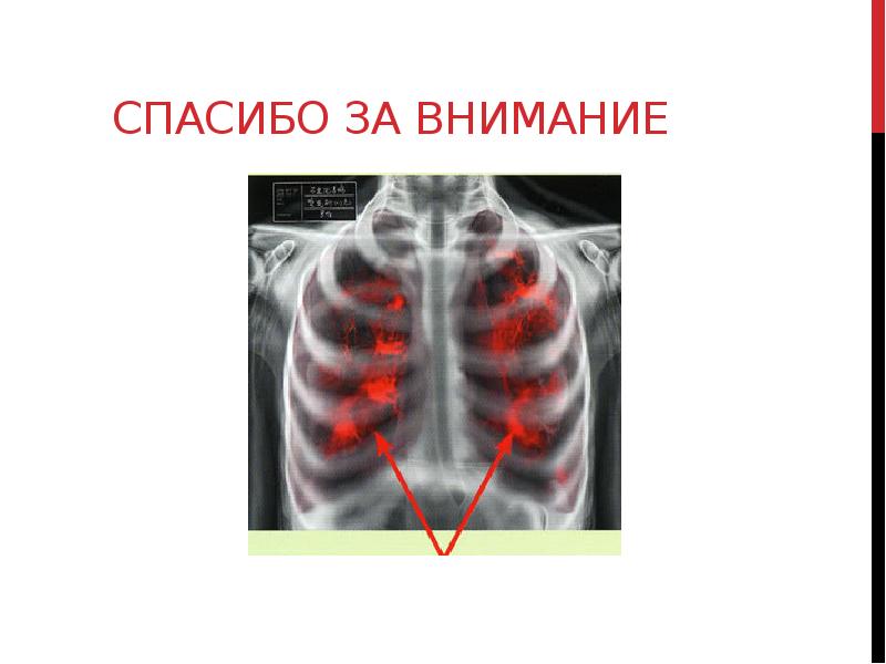 Спасибо за внимание