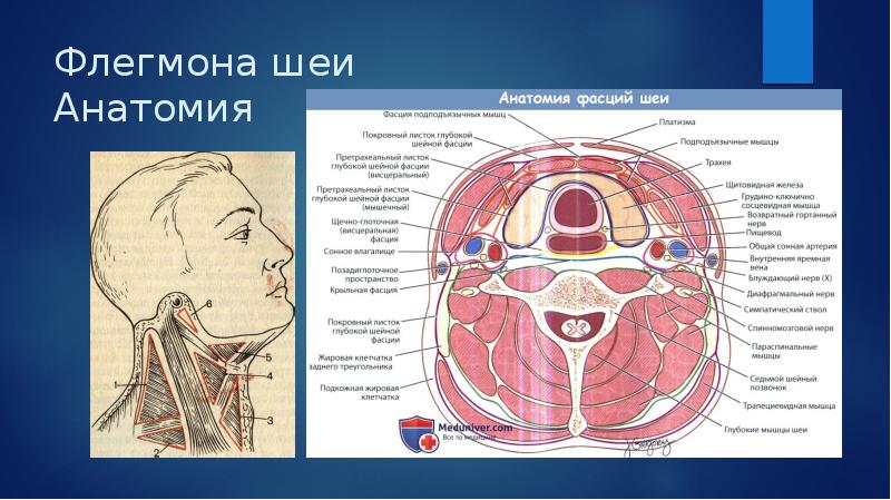 Флегмона шеи фото