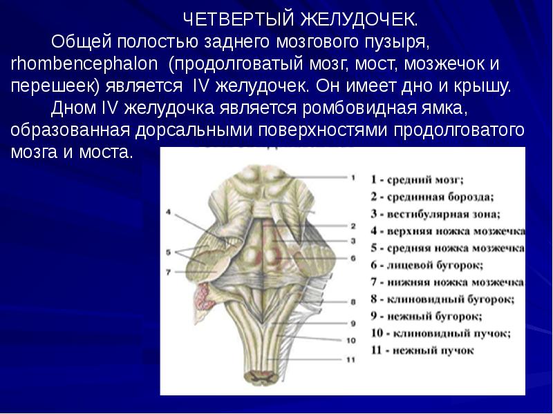 Расширение 4 желудочка