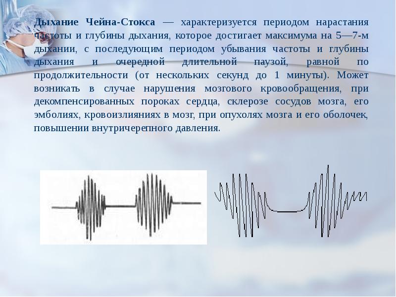 Дыхание чейна стокса схема