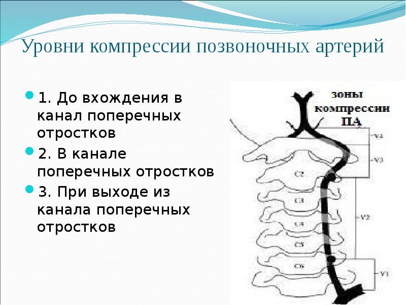 Экстравазальная компрессия артерий