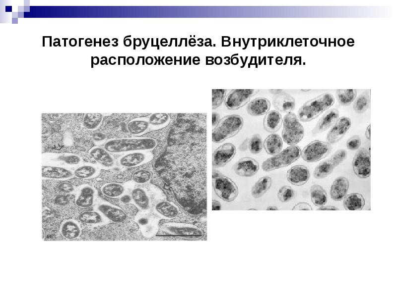 Туляремия микробиология презентация