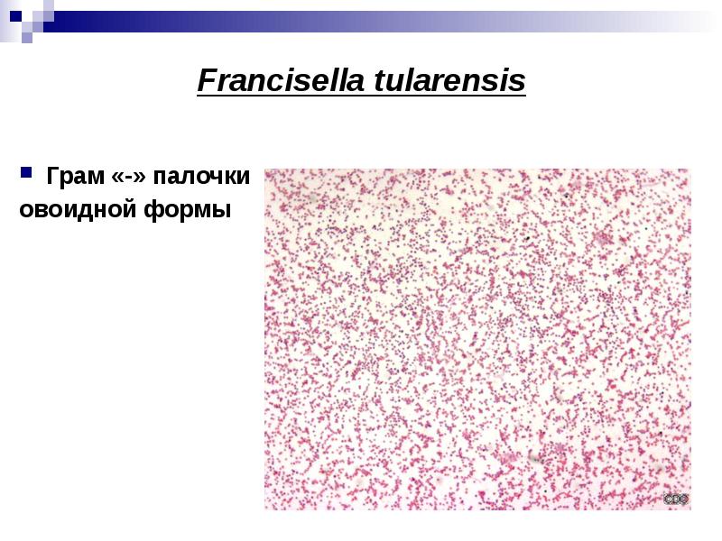 Возбудитель туляремии рисунок