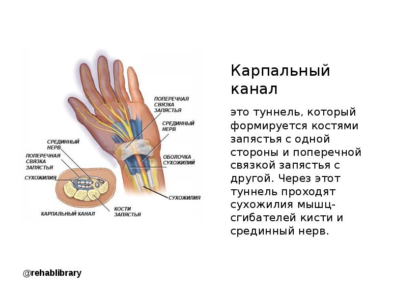 Лучистая связка запястья