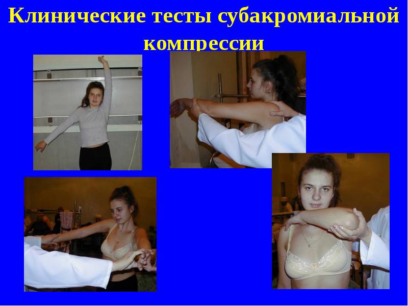 Клинические тесты субакромиальной компрессии Клинические тесты субакромиальной компрессии