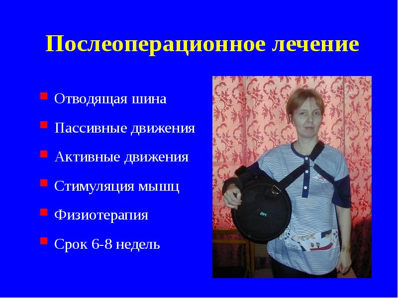 Послеоперационное лечение
Отводящая шина
Пассивные движения
Активные движения
Стимуляция мышц
Физиотерапия
Послеоперационное лечение
Отводящая шина
Пассивные движения
Активные движения
Стимуляция мышц
Физиотерапия