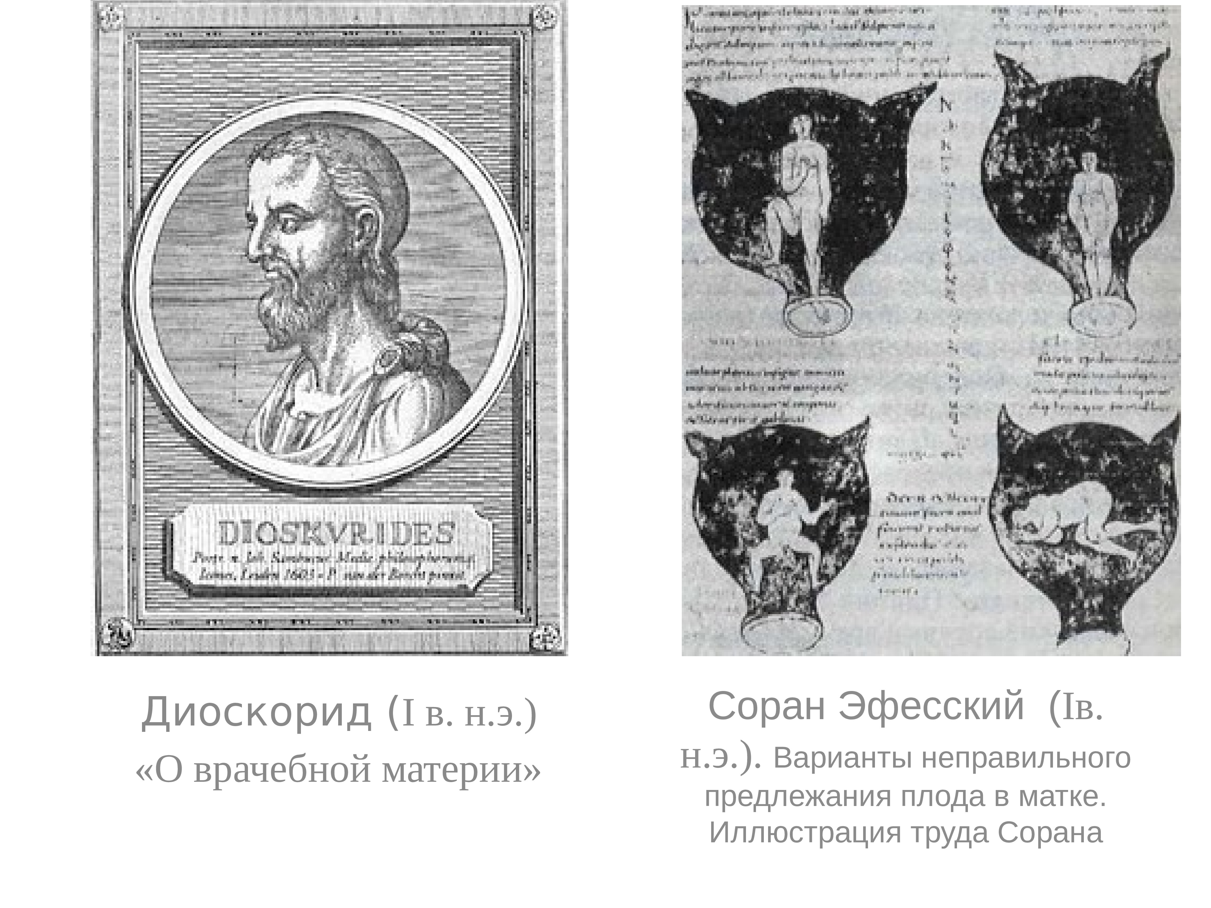 соран эфесский вклад в медицину. соран эфесский гинекология. соран эфесский в древнем риме. соран эфесский. соран эфесский портрет.