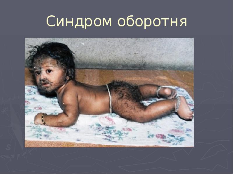 Синдром оборотня