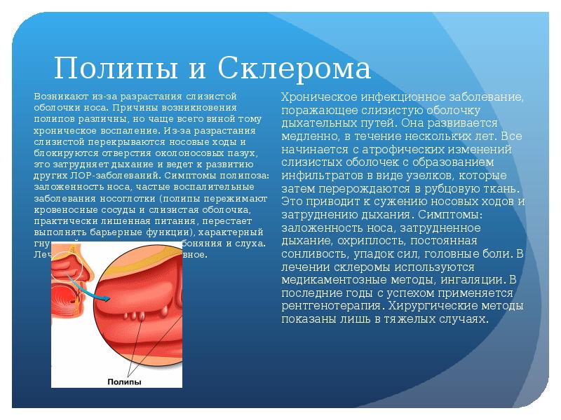 Воспалительное заболевание носовой полости. Заболевания носа названия. Заболевание характеристика фронтит. Заболевания носа и придаточных пазух. Заболевания пазух носа.