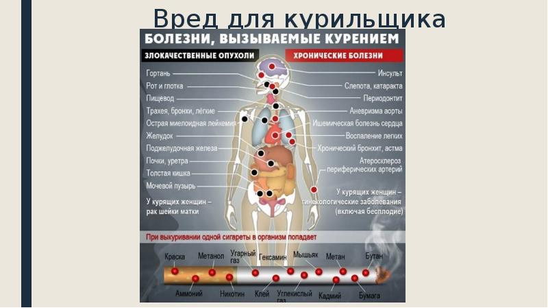 Болезни вызванные курением презентация