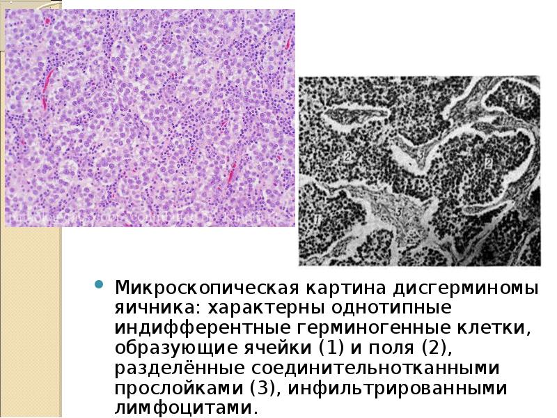 Микроскопическая картина u