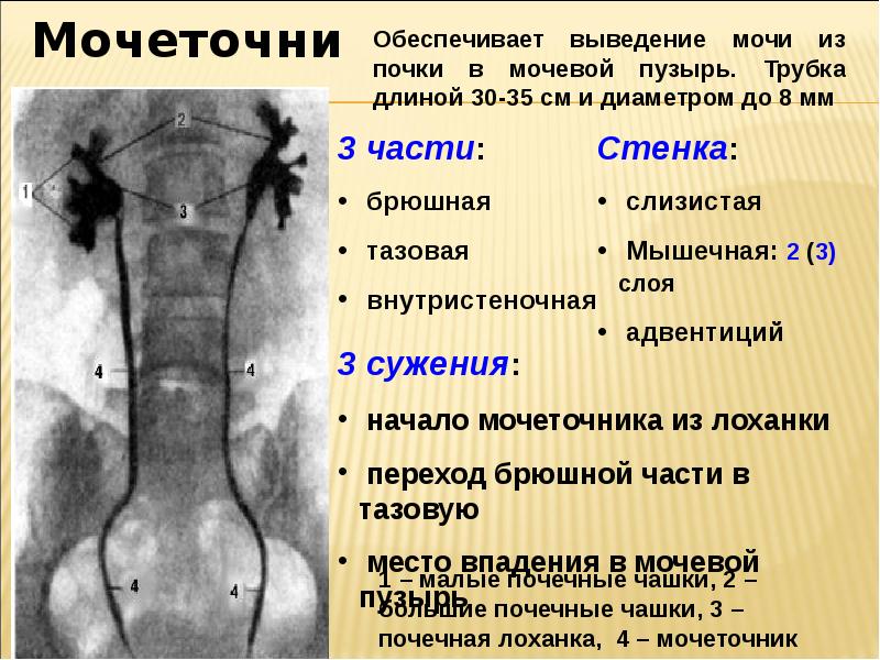 Устье левого мочеточника фото