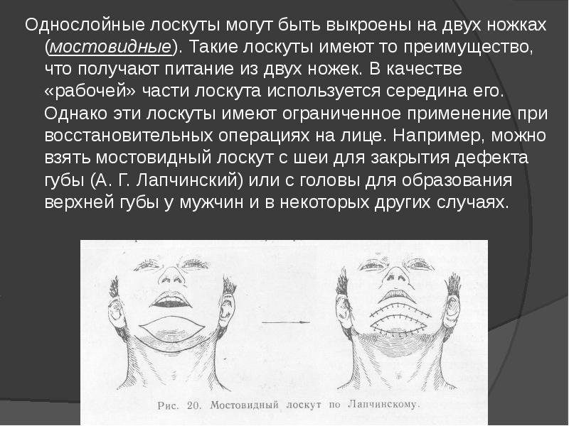 Лоскут используют. Мостовидный лоскут Лексера. Лоскут на двух питающей ножке.