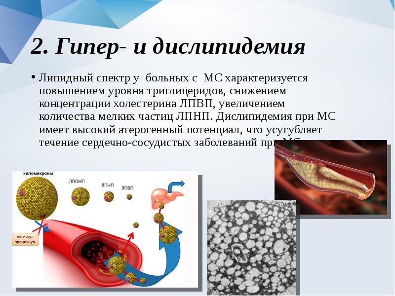 Гипер igm синдром презентация