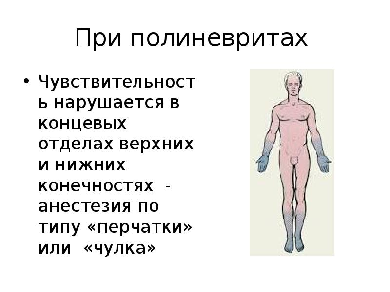 Презентация невриты и полиневриты