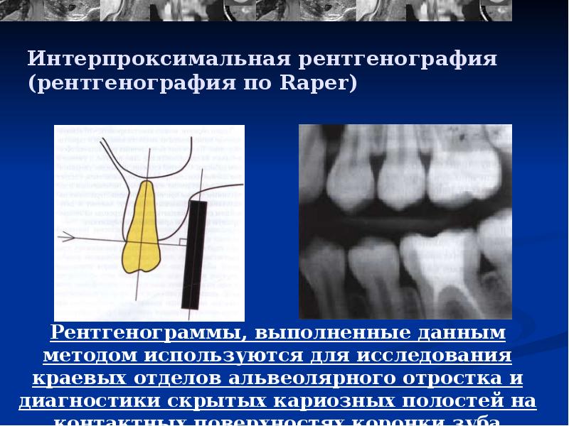 Рентгенодиагностика в стоматологии презентация