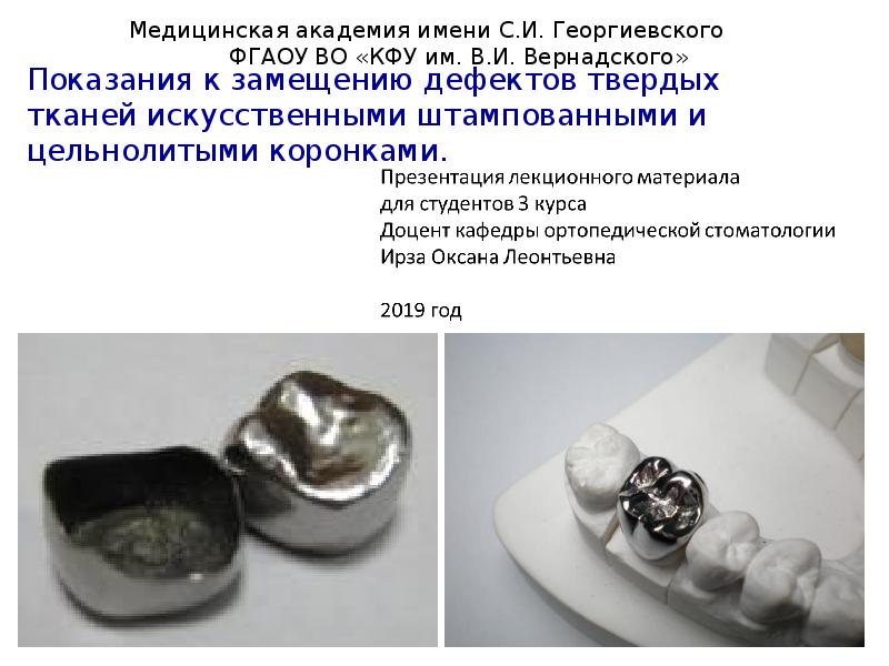 Показания к замещению дефектов твердых тканей искусственными штампованными и цельнолитыми коронками.