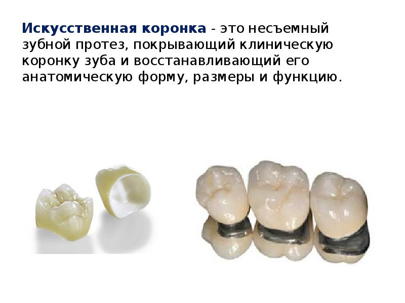 Искусственная коронка&nbsp;- это несъемный зубной протез, покрывающий клиническую коронку зуба и