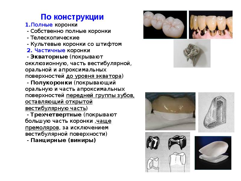 По конструкции 1.Полные коронки  - Собственно полные коронки  -