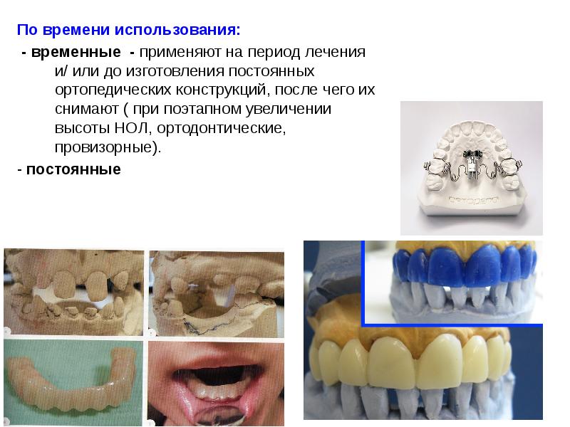 Временные коронки презентация