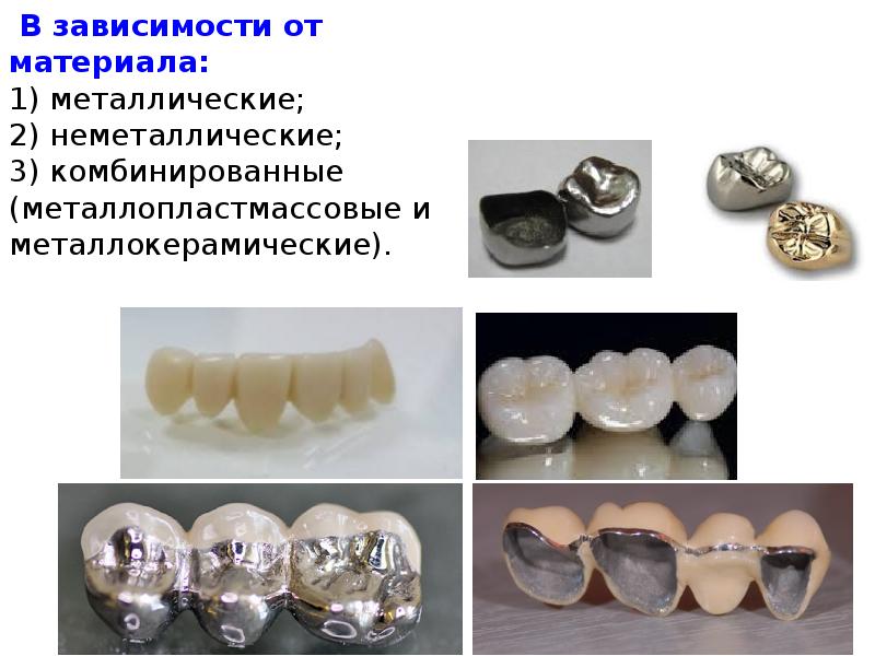В зависимости от материала: 1) металлические; 2) неметаллические; 3) комбинированные (металлопластмассовые
