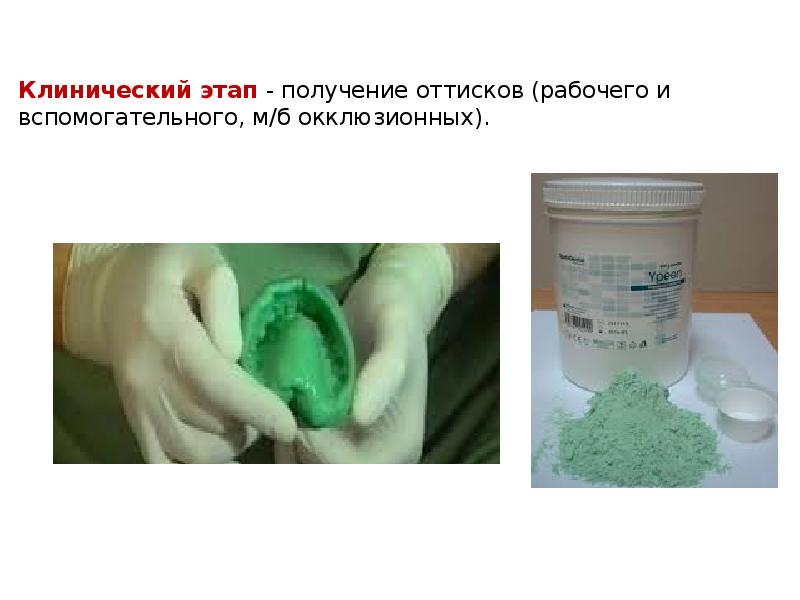Клинический этап - получение оттисков (рабочего и вспомогательного, м/б окклюзионных).