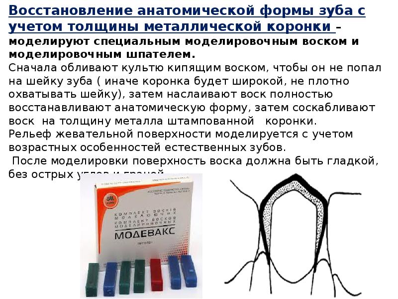 Восстановление анатомической формы зуба с учетом толщины металлической коронки – моделируют