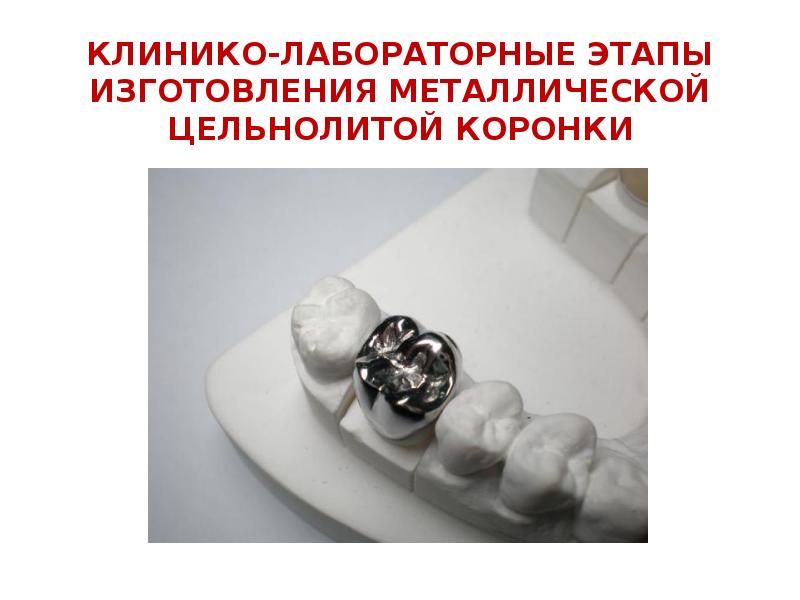 КЛИНИКО-ЛАБОРАТОРНЫЕ ЭТАПЫ ИЗГОТОВЛЕНИЯ МЕТАЛЛИЧЕСКОЙ ЦЕЛЬНОЛИТОЙ КОРОНКИ