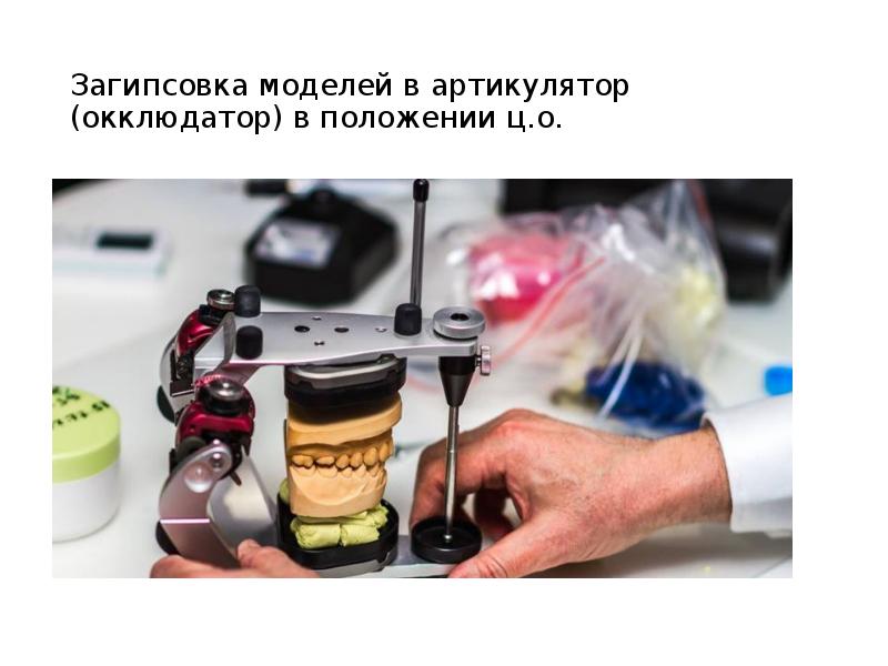 Загипсовка моделей в артикулятор (окклюдатор) в положении ц.о.